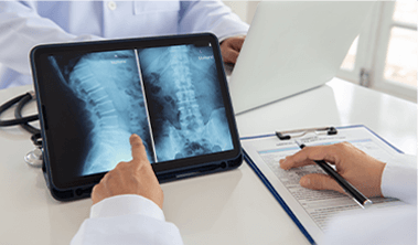 x-ray
