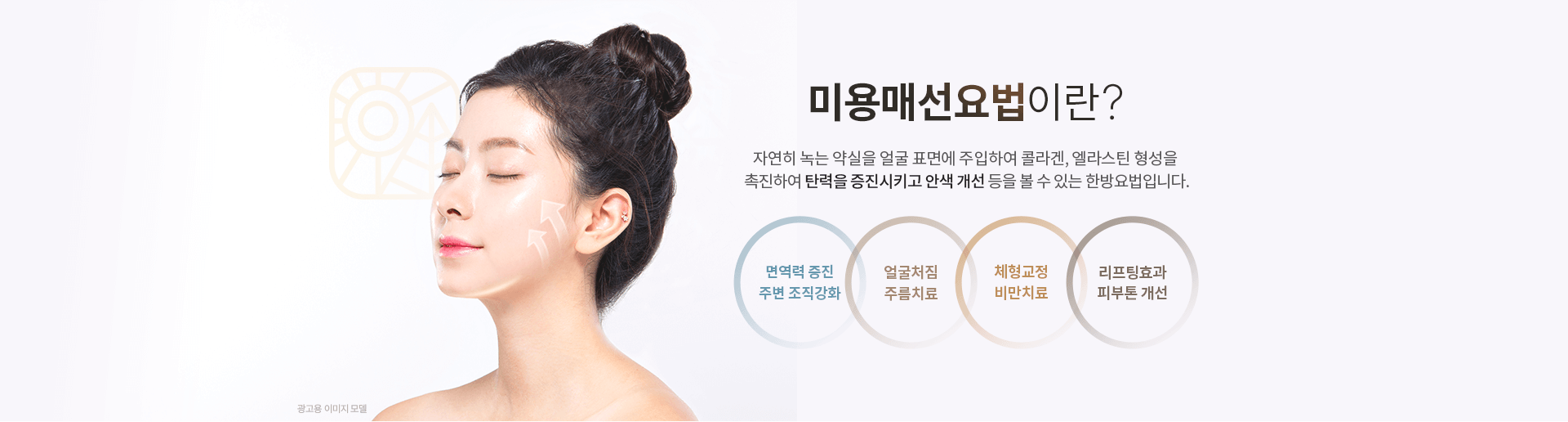 매선요법