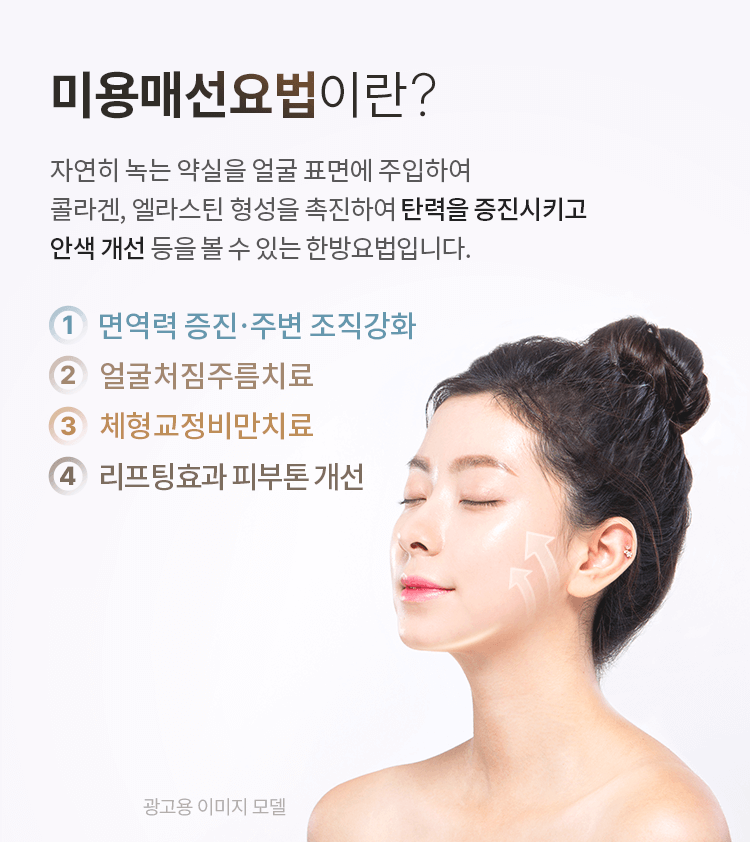 매선요법